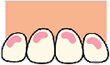 CS�̎菇